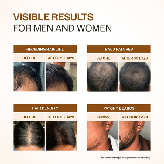 BARE ANATOMY EXPERT ADV HAIR GROWTH SERUM 30ML