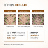 BARE ANATOMY EXPERT ADV HAIR GROWTH SERUM 30ML