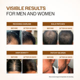 BARE ANATOMY EXPERT ADV HAIR GROWTH SERUM 30ML