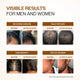 BARE ANATOMY EXPERT ADV HAIR GROWTH SERUM 30ML