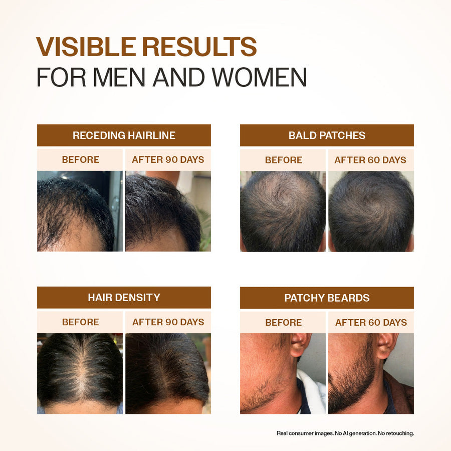 BARE ANATOMY EXPERT ADV HAIR GROWTH SERUM 30ML